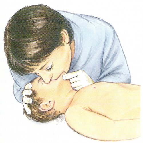Resuscitating a child