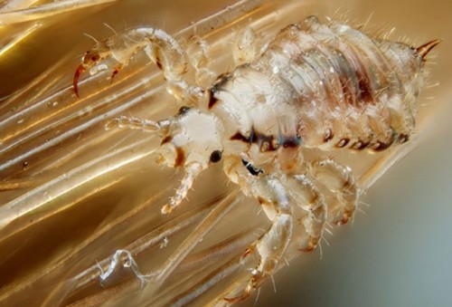 head louse, the cause of pediculosis capitus - Wikipedia commons