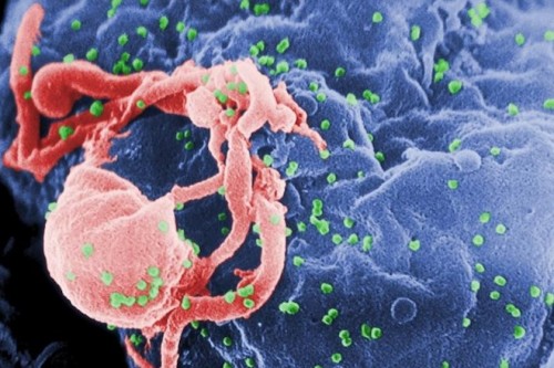 Electron microscope image of HIV virus particles budding off a cell where they are replicating.