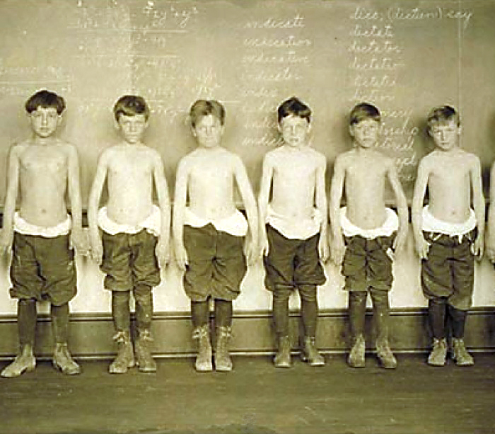 Vintage photo of 9-10 year old boys getting health checkups at school