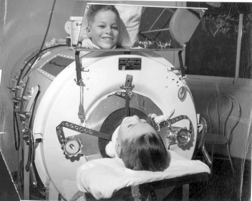 12 year old boy in an iron lung due to Polio - vintage photograph