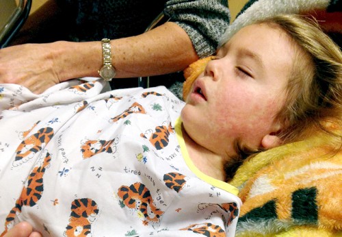 Unimmunized girl in hospital with measles