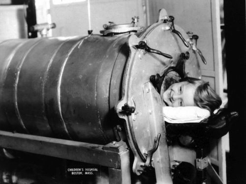 Vintage photo of young girl with polio in an iron lung