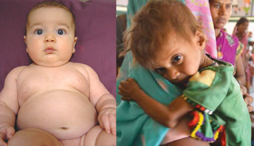 One year olds - BOTH MALnourished