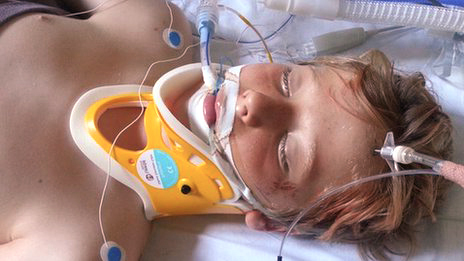 Boy in a coma following a traumatic brain injury - head injury