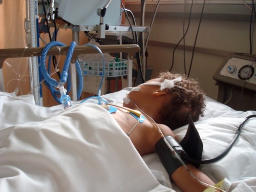 Boy with ruptured appendix in the ICU