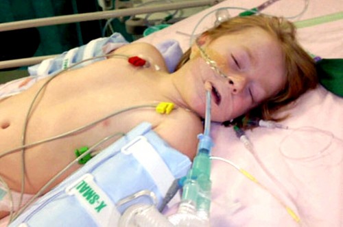 Boy child in ICU on respirator with influenza