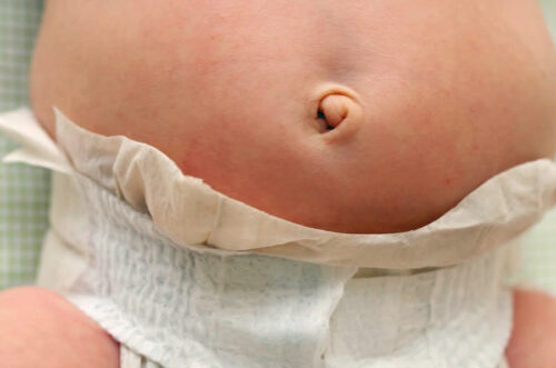 Newborn bellybutton